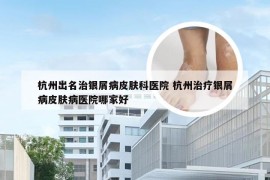 杭州出名治银屑病皮肤科医院 杭州治疗银屑病皮肤病医院哪家好