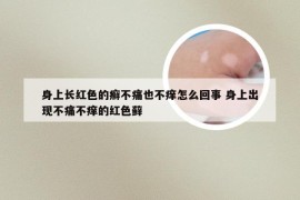 身上长红色的癣不痛也不痒怎么回事 身上出现不痛不痒的红色藓