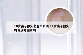 10岁孩子额头上有小白斑 10岁孩子额头有白点咋回事啊