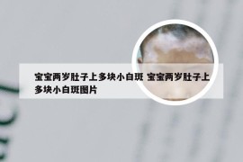 宝宝两岁肚子上多块小白斑 宝宝两岁肚子上多块小白斑图片