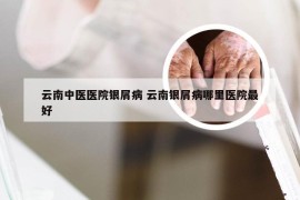 云南中医医院银屑病 云南银屑病哪里医院最好