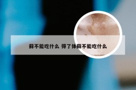 藓不能吃什么 得了体藓不能吃什么