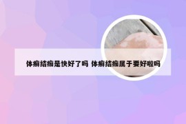 体癣结痂是快好了吗 体癣结痂属于要好啦吗