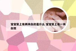 宝宝背上有两块白的是什么 宝宝背上有一块白斑