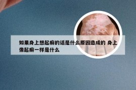 如果身上想起癣的话是什么原因造成的 身上像起癣一样是什么