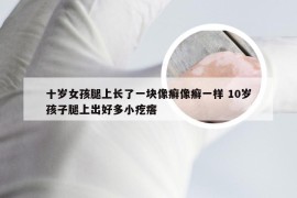 十岁女孩腿上长了一块像癣像癣一样 10岁孩子腿上出好多小疙瘩