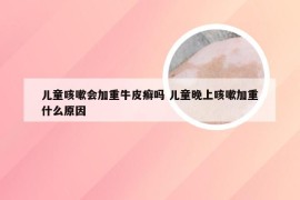 儿童咳嗽会加重牛皮癣吗 儿童晚上咳嗽加重什么原因