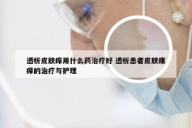 透析皮肤痒用什么药治疗好 透析患者皮肤瘙痒的治疗与护理