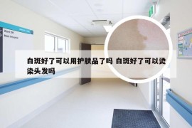 白斑好了可以用护肤品了吗 白斑好了可以烫染头发吗