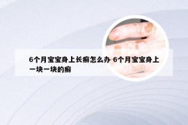 6个月宝宝身上长癣怎么办 6个月宝宝身上一块一块的癣