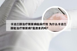 卡泊三醇治疗银屑病临床疗效 为什么卡泊三醇能治疗银屑病?是激素药吗?