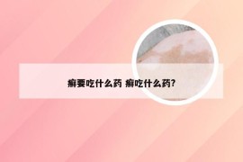 癣要吃什么药 癣吃什么药?