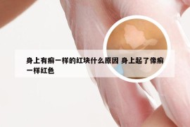 身上有癣一样的红块什么原因 身上起了像癣一样红色