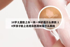 10岁儿童脸上白一块一块的是什么原因 10岁孩子脸上出现白色斑块是什么原因