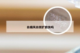 白癜风白斑扩散快吗