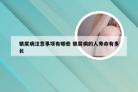 银屑病注意事项有哪些 银屑病的人寿命有多长