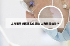 上海银屑病医保定点医院 上海银屑病治疗