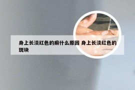 身上长淡红色的癣什么原因 身上长淡红色的斑块