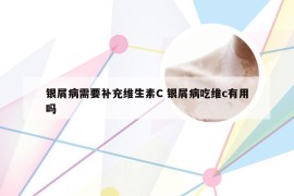 银屑病需要补充维生素C 银屑病吃维c有用吗