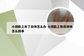 小孩脸上长了白块怎么办 小孩脸上有白块块怎么回事