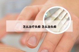 怎么冶疗头癣 怎么治头癣