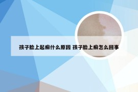 孩子脸上起癣什么原因 孩子脸上癣怎么回事