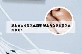 腿上有白点是怎么回事 腿上有白点儿是怎么回事儿?