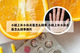 小腿上长小白点是怎么回事 小腿上长小白点是怎么回事图片