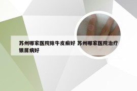 苏州哪家医院除牛皮癣好 苏州哪家医院治疗银屑病好