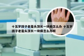 十五岁孩子老是头顶长一块癣怎么办 十五岁孩子老是头顶长一块癣怎么办呢