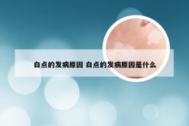 白点的发病原因 白点的发病原因是什么