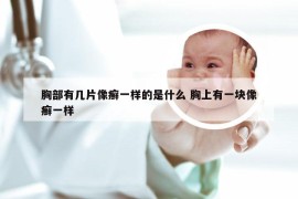 胸部有几片像癣一样的是什么 胸上有一块像癣一样