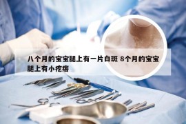 八个月的宝宝腿上有一片白斑 8个月的宝宝腿上有小疙瘩