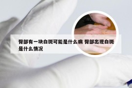 臀部有一块白斑可能是什么病 臀部出现白斑是什么情况