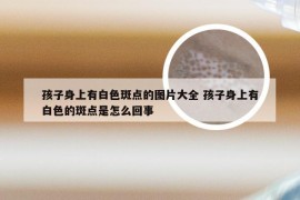 孩子身上有白色斑点的图片大全 孩子身上有白色的斑点是怎么回事