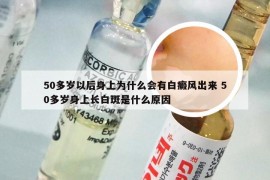 50多岁以后身上为什么会有白癜风出来 50多岁身上长白斑是什么原因