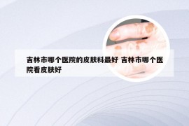 吉林市哪个医院的皮肤科最好 吉林市哪个医院看皮肤好