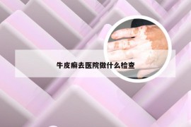 牛皮癣去医院做什么检查