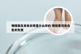 喉镜做出来有白斑是什么样的 喉镜看到有白色的东西