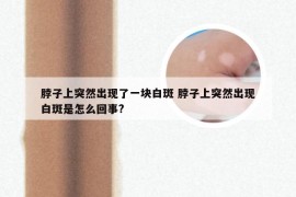 脖子上突然出现了一块白斑 脖子上突然出现白斑是怎么回事?