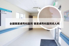 全国银屑病专科医院 银屑病专科医院坑人吗