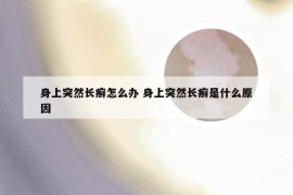 身上突然长癣怎么办 身上突然长癣是什么原因