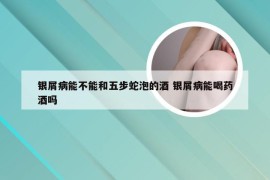 银屑病能不能和五步蛇泡的酒 银屑病能喝药酒吗