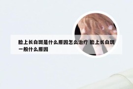 脸上长白斑是什么原因怎么治疗 脸上长白斑一般什么原因