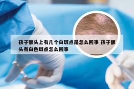 孩子额头上有几个白斑点是怎么回事 孩子额头有白色斑点怎么回事