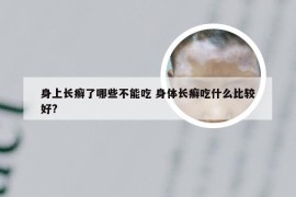 身上长癣了哪些不能吃 身体长癣吃什么比较好?