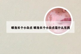 眼角长个小白点 眼角长个小白点是什么东西