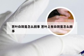 葱叶白斑是怎么回事 葱叶上有白斑是怎么回事