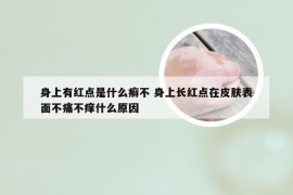 身上有红点是什么癣不 身上长红点在皮肤表面不痛不痒什么原因