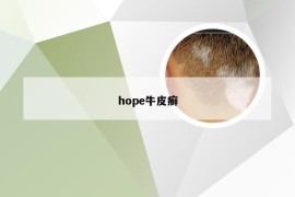 hope牛皮癣